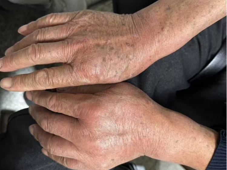 皇冠信用需要押金吗
_68岁大伯被蚂蚁围攻送进抢救室!短短十几秒爬满全身皇冠信用需要押金吗
,罪魁祸首竟是院子里的“宝贝”