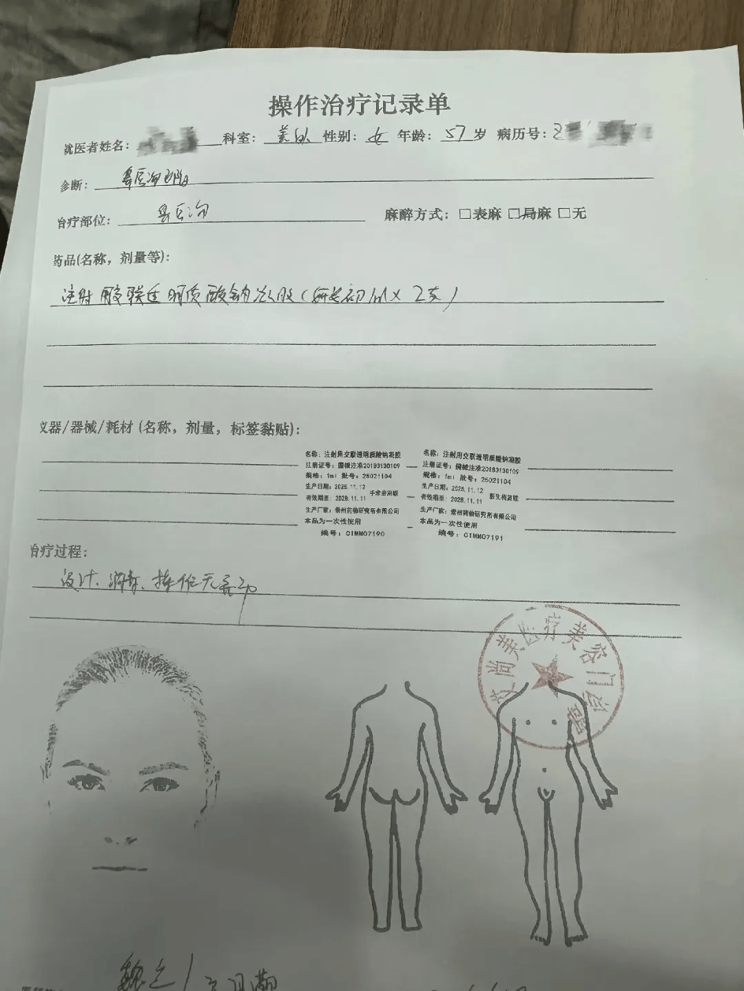 世界杯皇冠信用网代理_从600多元变成5万元世界杯皇冠信用网代理,广东57岁保洁员掏空积蓄做医美,双眼皮手术后眼睛红痛、视物模糊,当事人:销售像人贩子一样围着我;机构拒绝回应